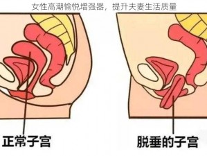 女性高潮愉悦增强器，提升夫妻生活质量