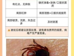 啊叔叔虫子吸出来了吗 啊叔叔，虫子吸出来了吗？被蜱虫叮咬后该怎么办呢？