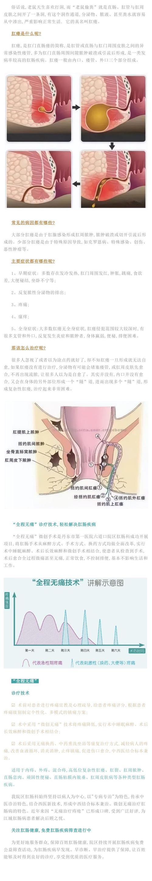 宋慧乔肛瘘——用这款神奇的产品，让你的肛肠健康重焕生机