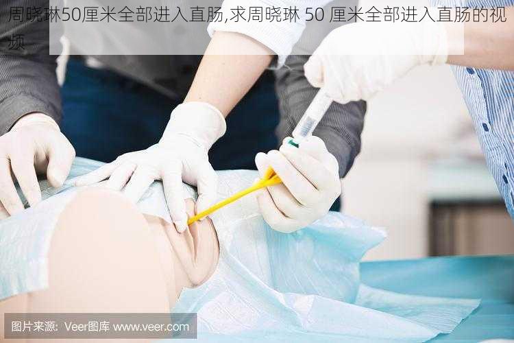 周晓琳50厘米全部进入直肠,求周晓琳 50 厘米全部进入直肠的视频