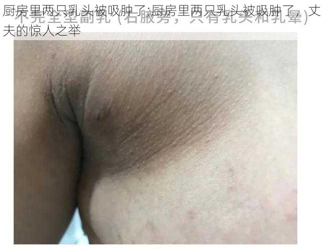 厨房里两只乳头被吸肿了;厨房里两只乳头被吸肿了，丈夫的惊人之举