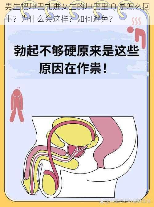 男生把坤巴扎进女生的坤巴里 Q 是怎么回事？为什么会这样？如何避免？